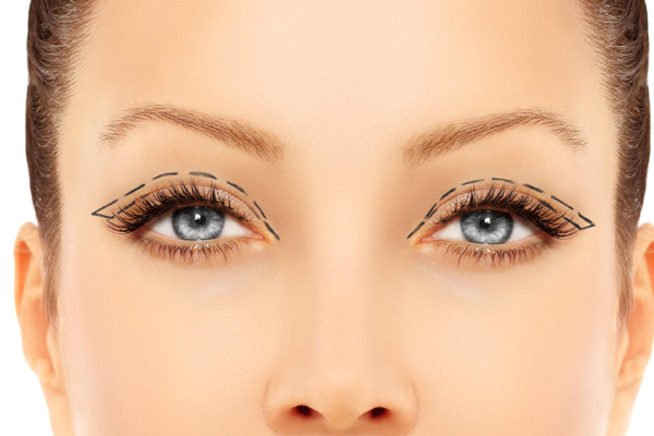 Eyelid Surgery